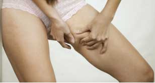 Chafing leads to pain and irritation of the skin