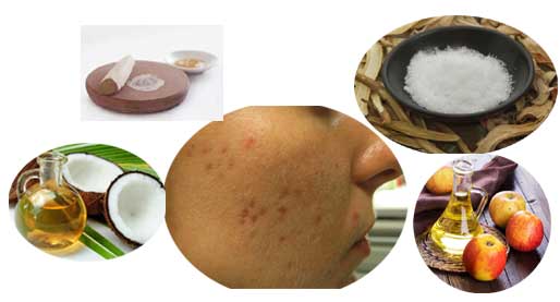 How to Get Rid of Pimple Marks Naturally