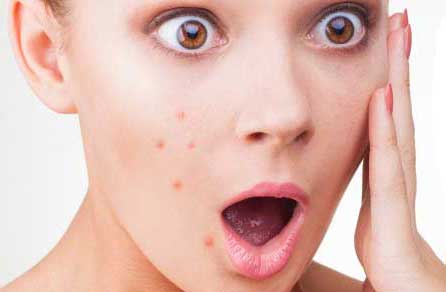 Home Remedies to Get Rid of Blemishes Faster