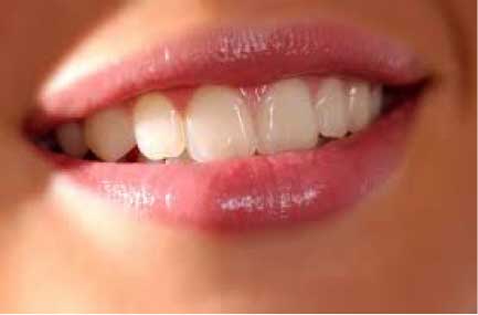 Tips for Beauty Smile