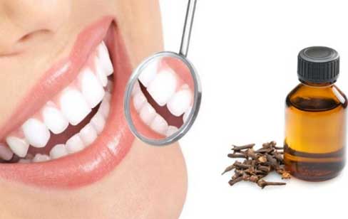 Clove Oil for Tooth Pain