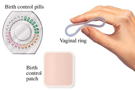 Effective Birth Control