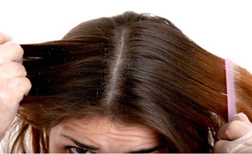 Sesame Hair Oil Prevents the Dryness of the Scalp