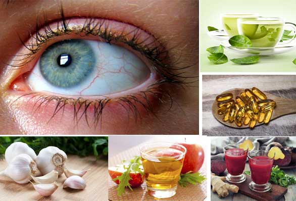 How You Can Get Rid Of Eye Floaters