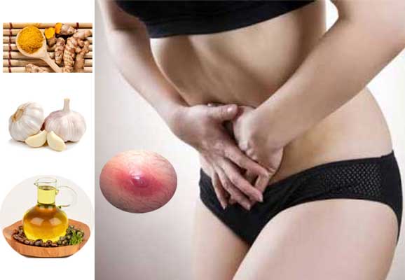 Home Remedies for Boil on Vaginal Lip or Private Area