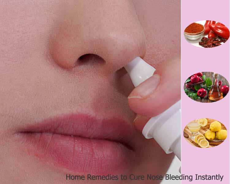 Home Remedies to Cure Nose Bleeding Instantly