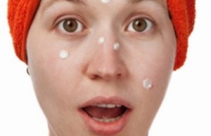 Homemade Remedies to Cure Pimples