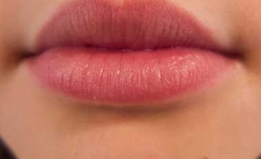 Home remedies  lip infections
