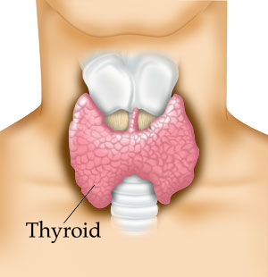 Things cause hypothyroidism in pregnancy