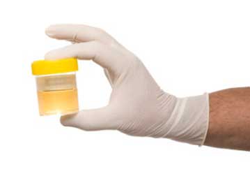 Urinary Tract Infection Diagnosed