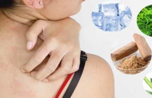 10 Home Remedies to Treat the Prickly Heat Rash