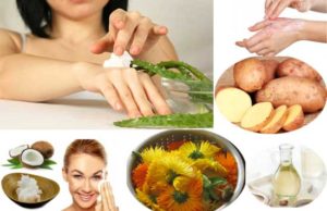 10 Top Home Remedies For Soothing A Burn On The Skin