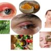 6 Home Remedies for Stye on Upper Eyelid