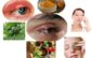 Home Remedies for Stye on Upper Eyelid