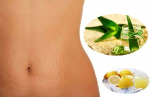 9 Natural Home Remedies to Remove Pregnancy Stretch Marks