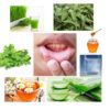 Canker Sores: Causes and Top Home Remedies for Canker Sores