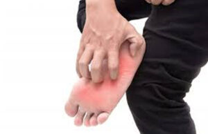 How To Reduce Burning Sensation in Feet