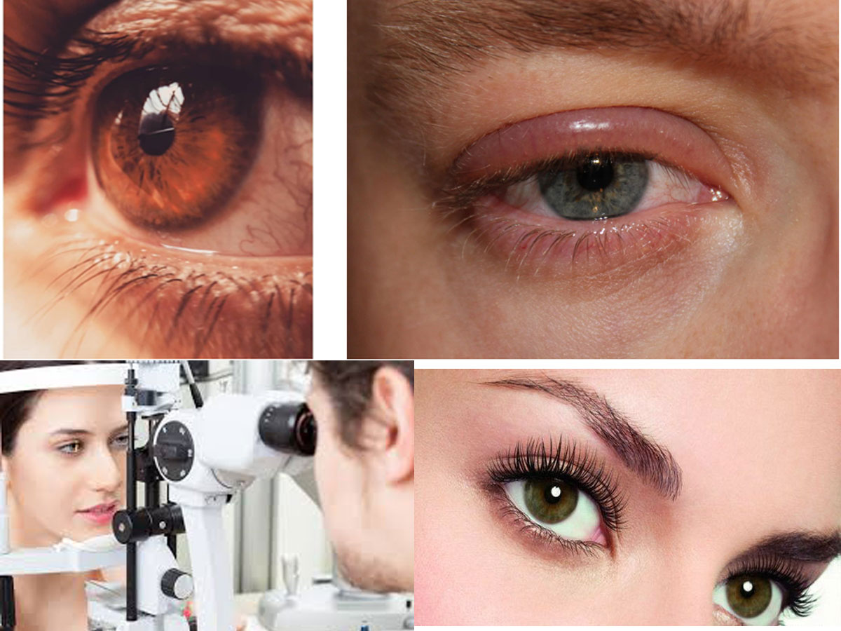 Eyecare: Ophthalmology, Eye examination, Common disorders, it's Symptoms, Treatment