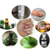 6 Home Remedies to Treat Paronychia