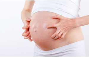 What is Cholestasis Of Pregnancy