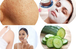 Home Remedies for Open Pores on Face