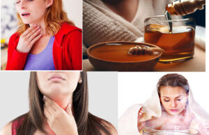 Remedies For Tickle In Throat, Causes, & How To Prevent It With Best Home Remedies