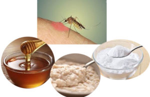Treating mosquito bites with Home remedies