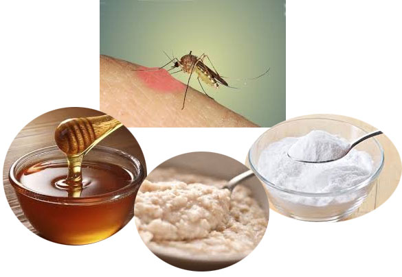 Treating mosquito bites with Home remedies