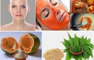 Home Remedies Will Give You Freedom From Uneven Skin