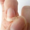 15 Learn What Your Nails Say About Your Health