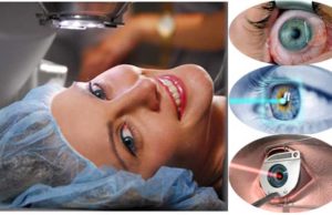 A Complete Guide to LASIK Eye Surgery