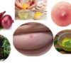 5 Home Remedies for Breast Boil