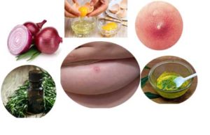How To Reduce For Breast Boil