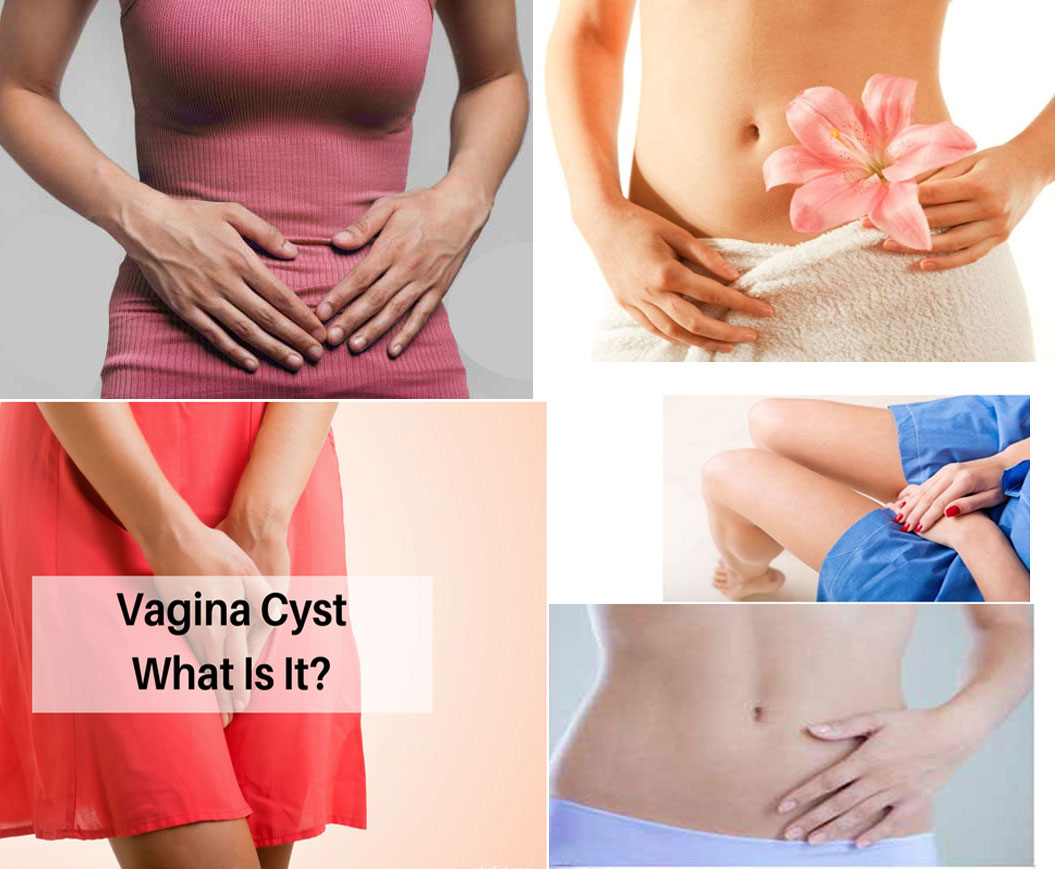 Causes And Symptoms Of Cyst Below Your Waist and Treatment