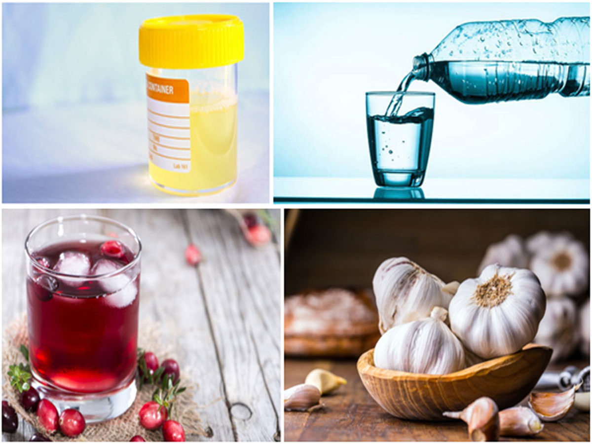 Some Home Remedies To Treat Cloudy Urine