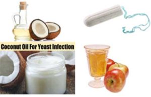 Vaginal Yeast Infection with Coconut Oil