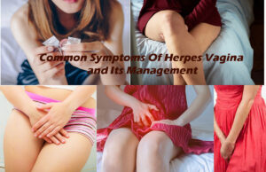 Common Symptoms Of Herpes Vagina and Its Management