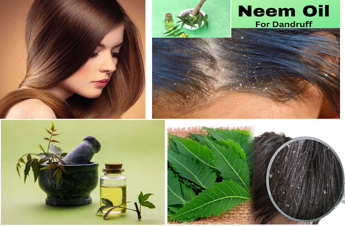 Neem Oil for Dandruff: 8 Effective Ways to Cure Dandruff with Neem Oil