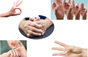 Exercises To Treat Arthritis In Hands And Increase The Mobility
