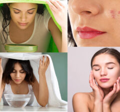 The Benefits of Facial Steam for Acne