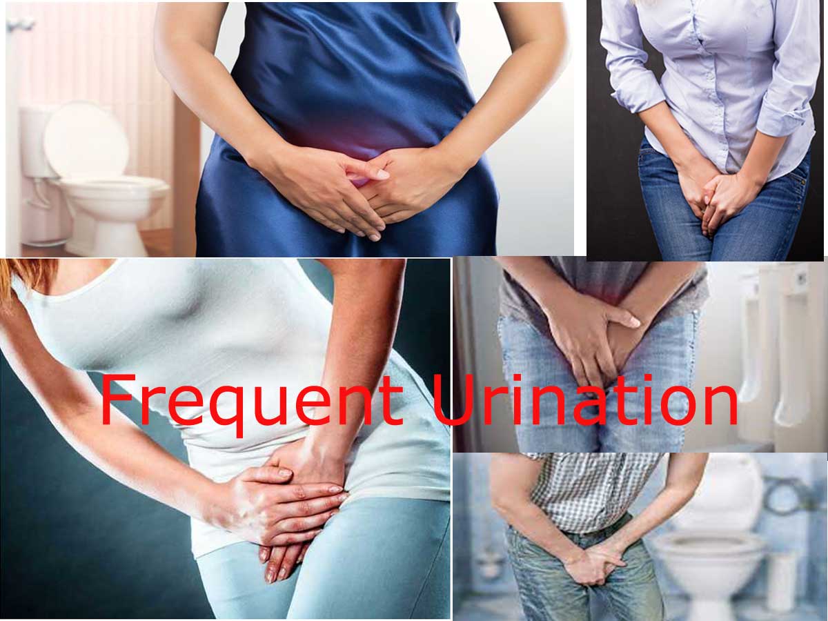 Frequent Urination- Causes,Symptoms,Diagnosis,Treatment,Prevention