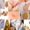 Get Over From Private Part Boils With Home Remedies
