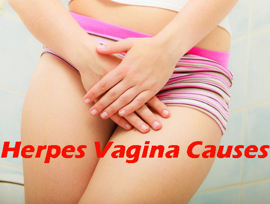 Herpes Vagina Causes