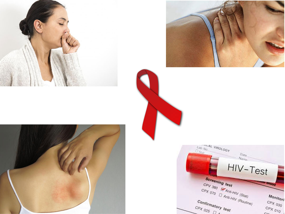 What is HIV? Symptoms and Early Signs Of HIV 
