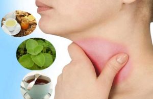 Home Remedies for a Sore Throat