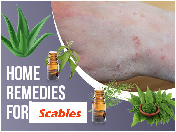 Natural Home Remedies For Scabies