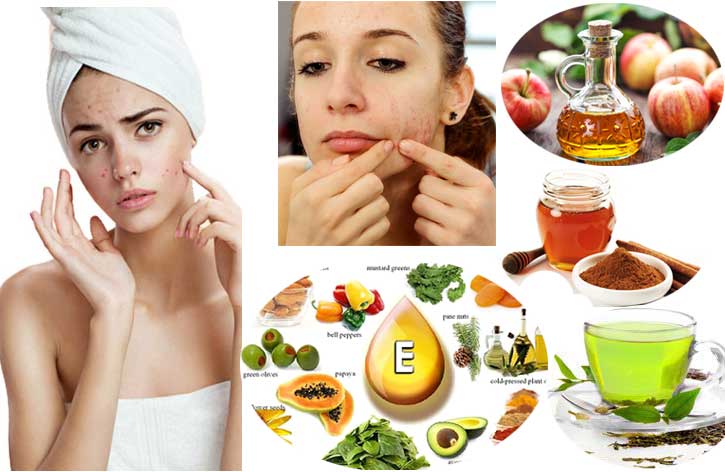 Home Remedies for Teenage Pimples at Home - Home Health Beauty Tips