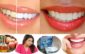 Home Remedies to Bring Sparkle Whiten Teeth at Home