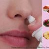 12 Home Remedies to Cure Nose Bleeding Instantly | Causes, Home Remedies, Preventive Tips