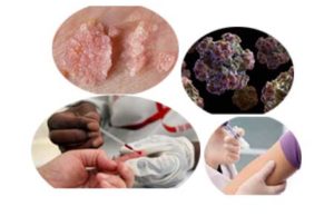 What is Human Papilloma Virus Infection